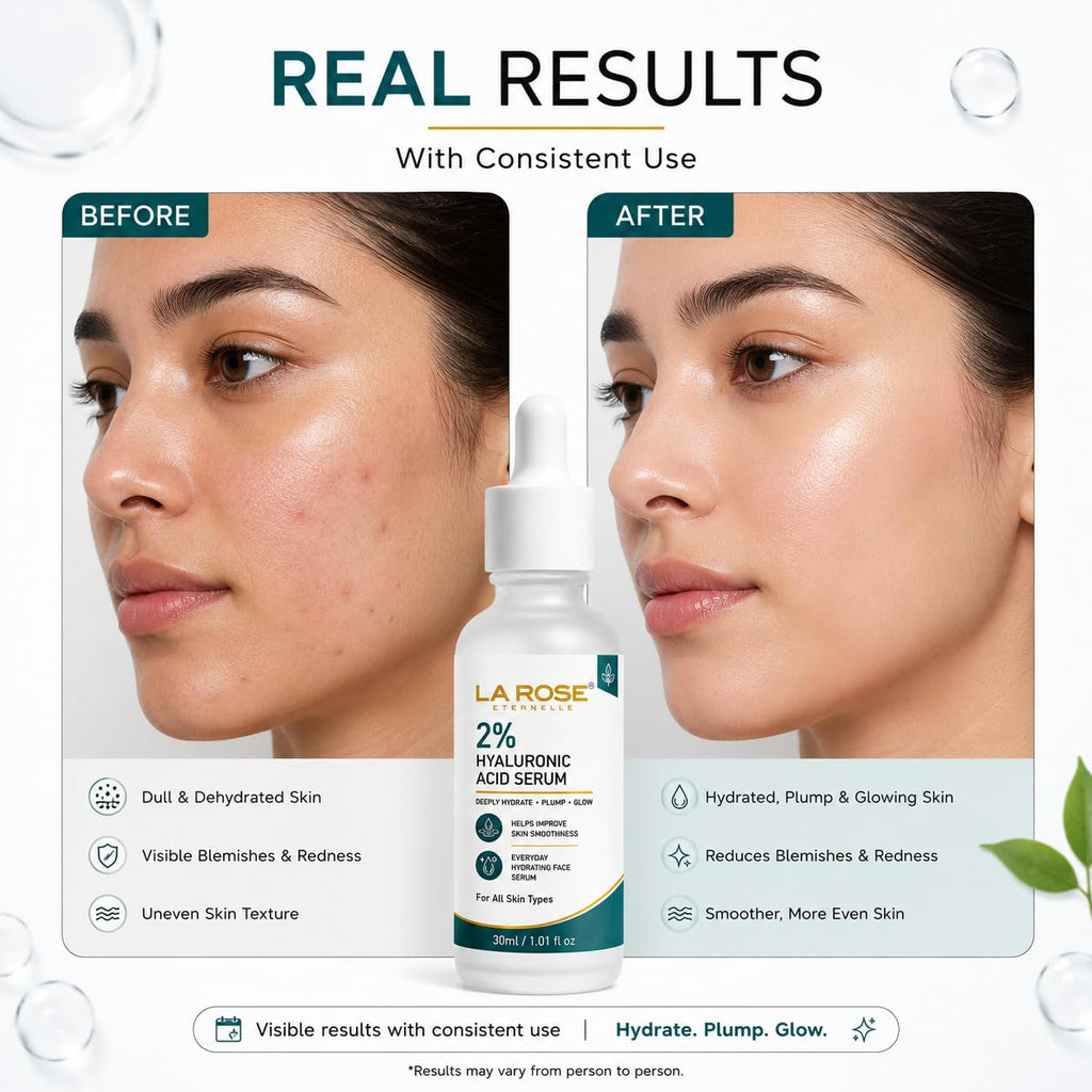 LaRose Eternelle 2% Hyaluronic Acid Face Serum 30ml for Deep Hydration & Plump Looking Skin, Everyday Hydrating Facial Serum, Helps Improve Skin Smoothness, For All Skin Types