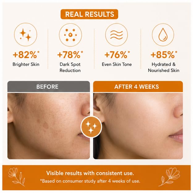 LA ROSE ETERNELLE Kojic Acid Face Cream, Clear & Radiant Skin, Uneven Skin Tone Care, 50ml