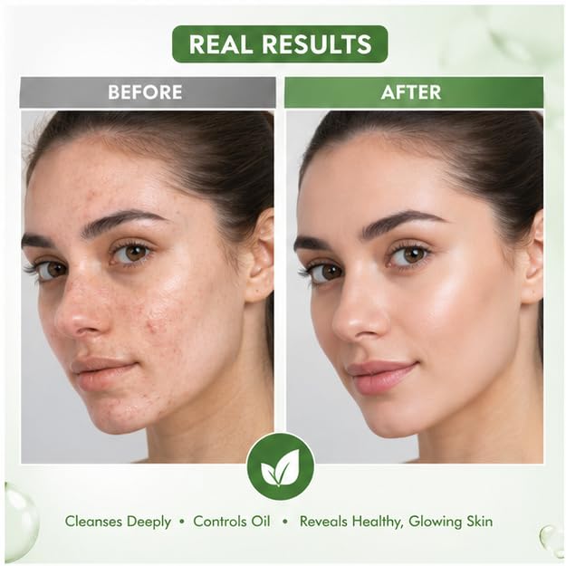 LA ROSE ETERNELLE Green Tea Face Wash with Neem Tea Tree Oil & Aloe Vera | Daily Facial Cleanser for Oily Skin | Refreshing Face Wash for Men & Women | 150 ml