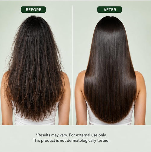 LA ROSE ETERNELLE Rosemary Shampoo, Anti Hair Fall, Frizz-Free, Split Ends Treatment, All Hair Types, 200ml