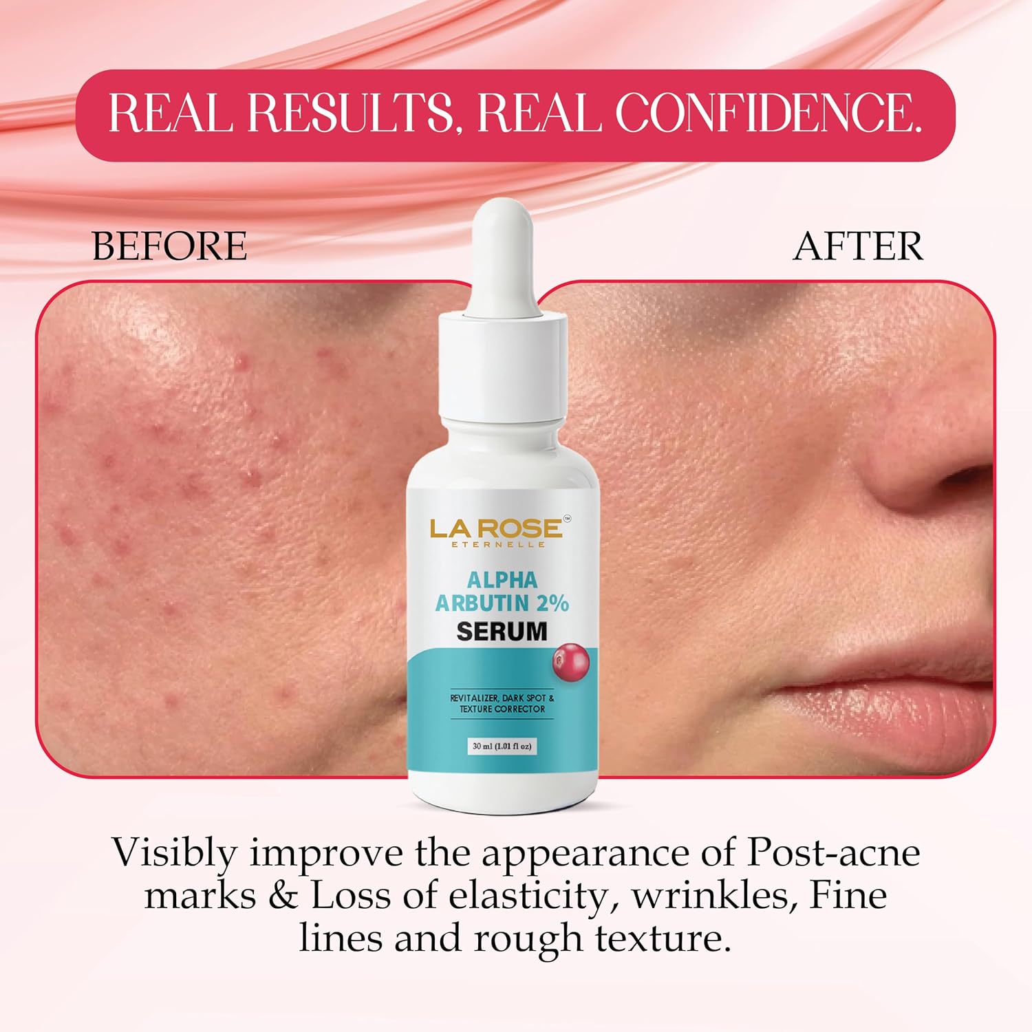 LA ROSE ETERNELLE Alpha Arbutin 2% Serum, Dark Spot & Texture Corrector, 30ml